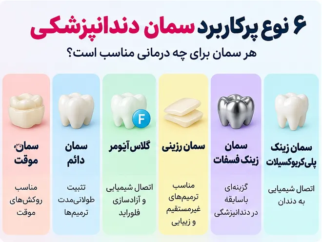 معرفی ۶ نوع سمان دندانپزشکی شامل موقت، دائم، گلاس آینومر، رزینی، زینک فسفات و پلی کربوکسیلات
