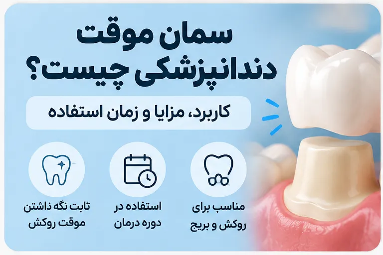 سمان موقت دندان پزشکی و کاربرد آن برای روکش دندان